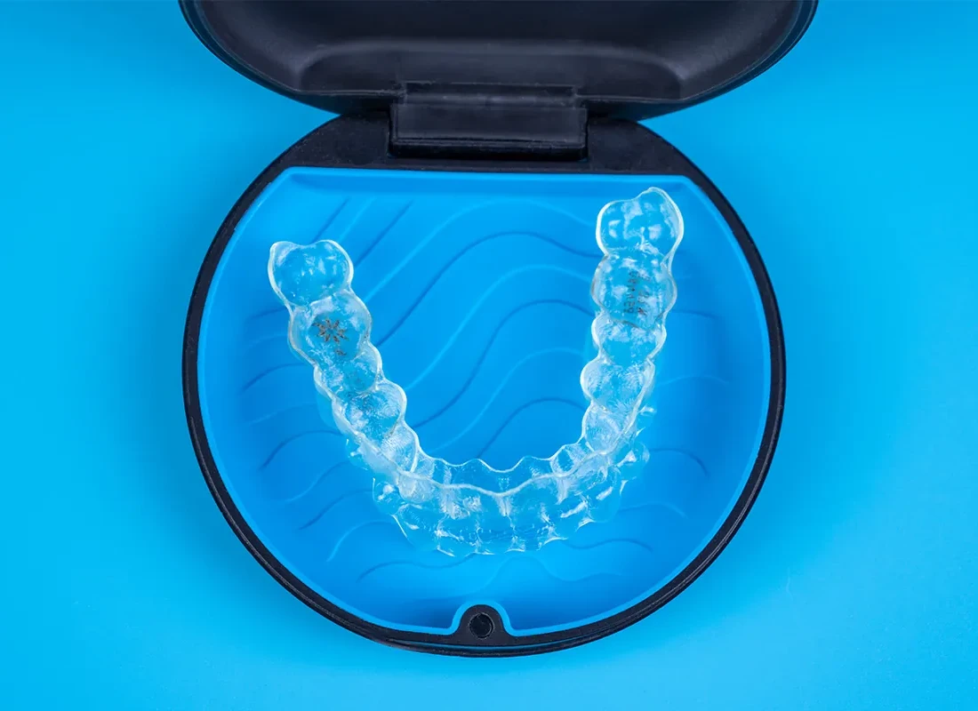 Invisalign Clear Aligners