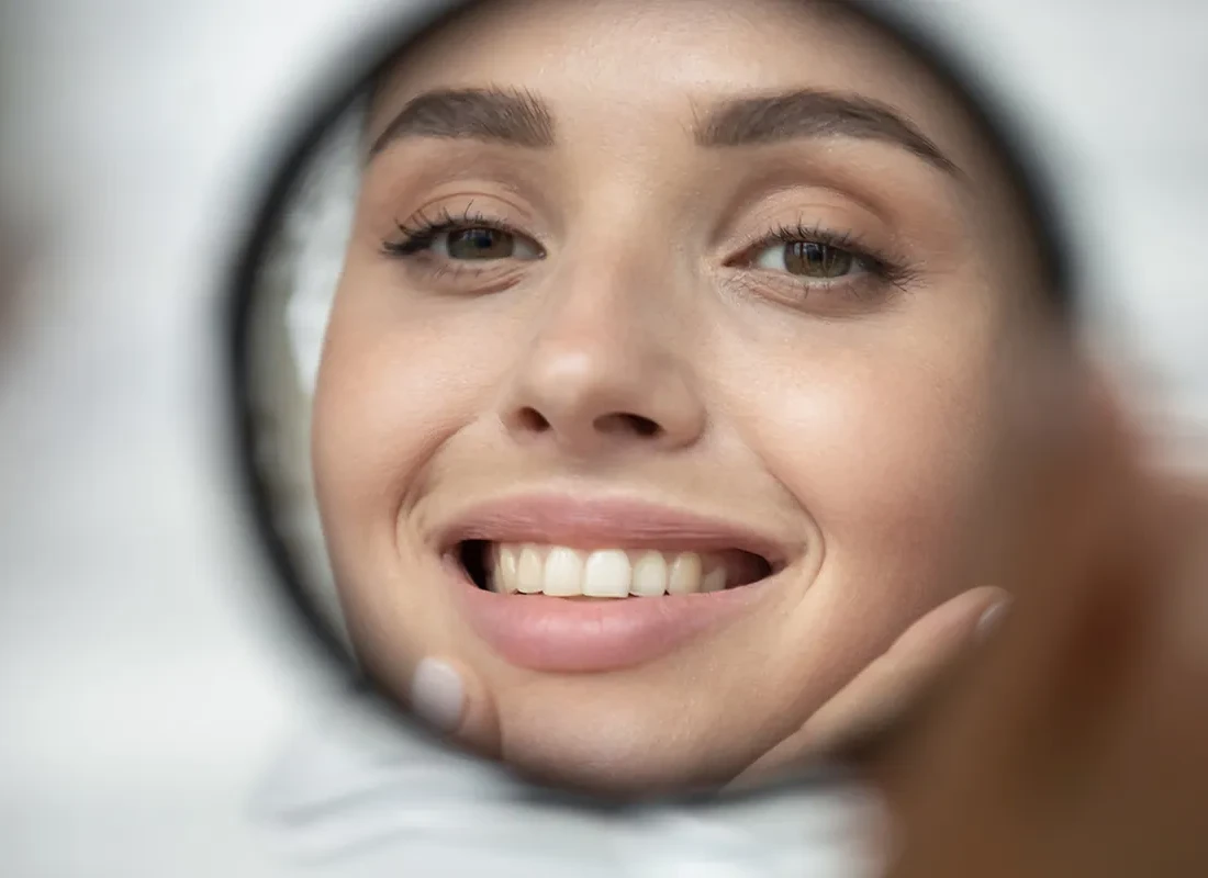 Smile Makeovers