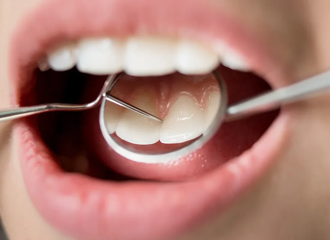 Keeping Little Smiles Healthy: A Parent's Guide to Preventing Cavities in Kids