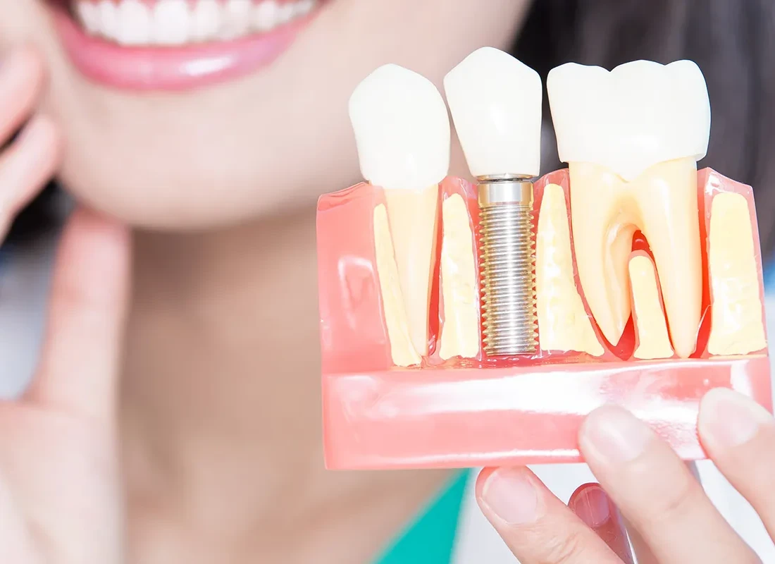 How Our Woodland Hills Dentist Handles Tooth Implant Problems