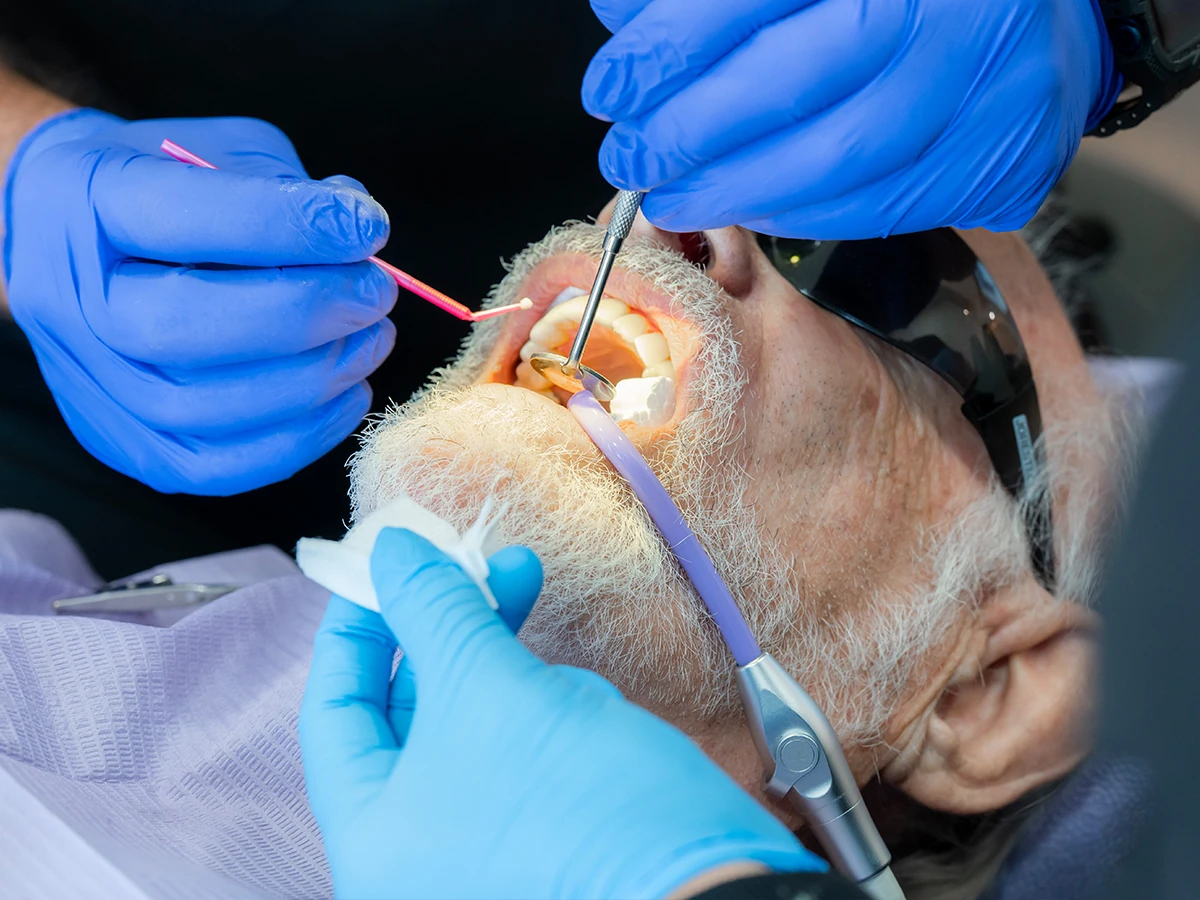 Root Canal at Woodland Hills Family Dentistry