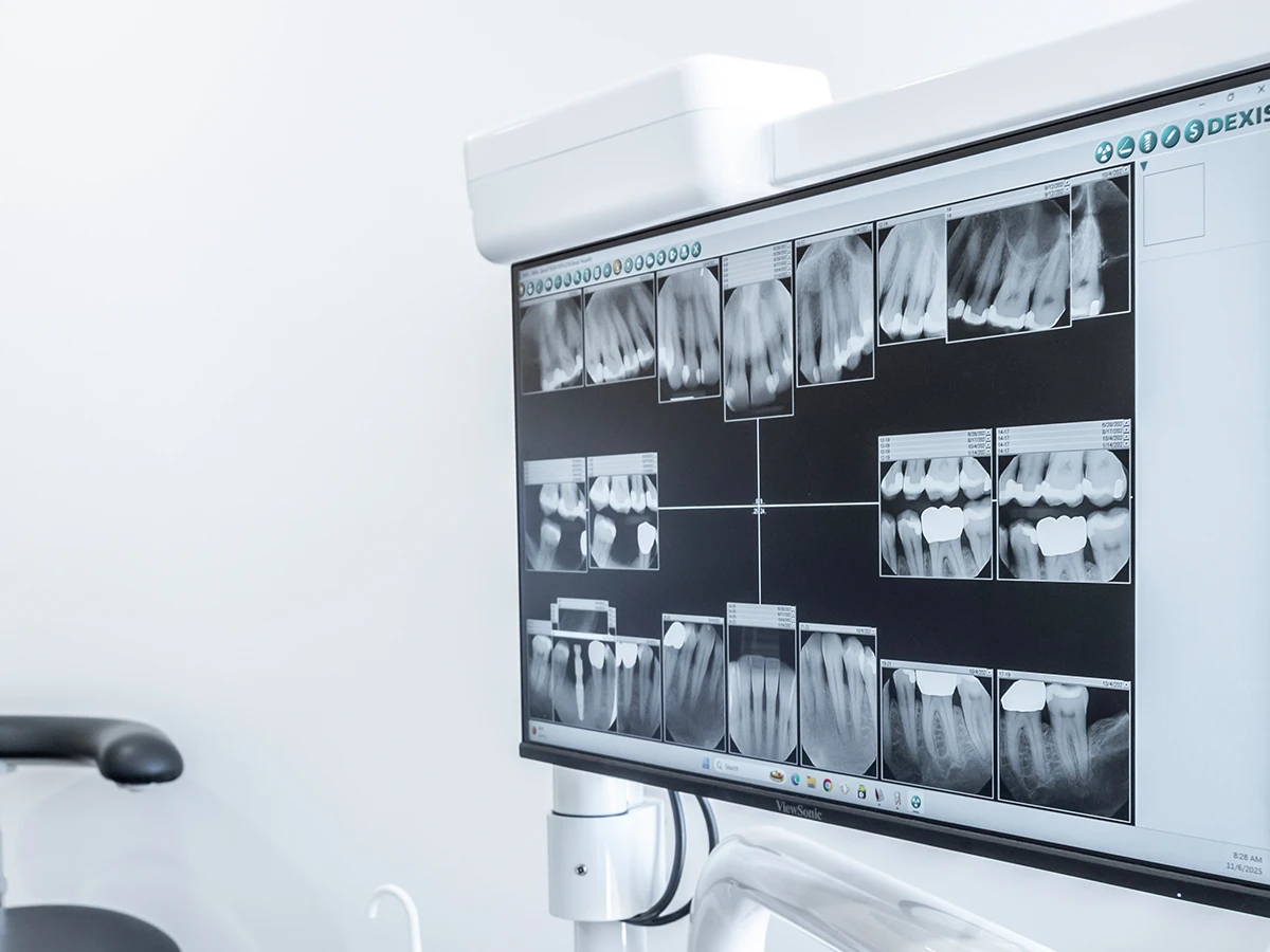 What is restorative dentistry