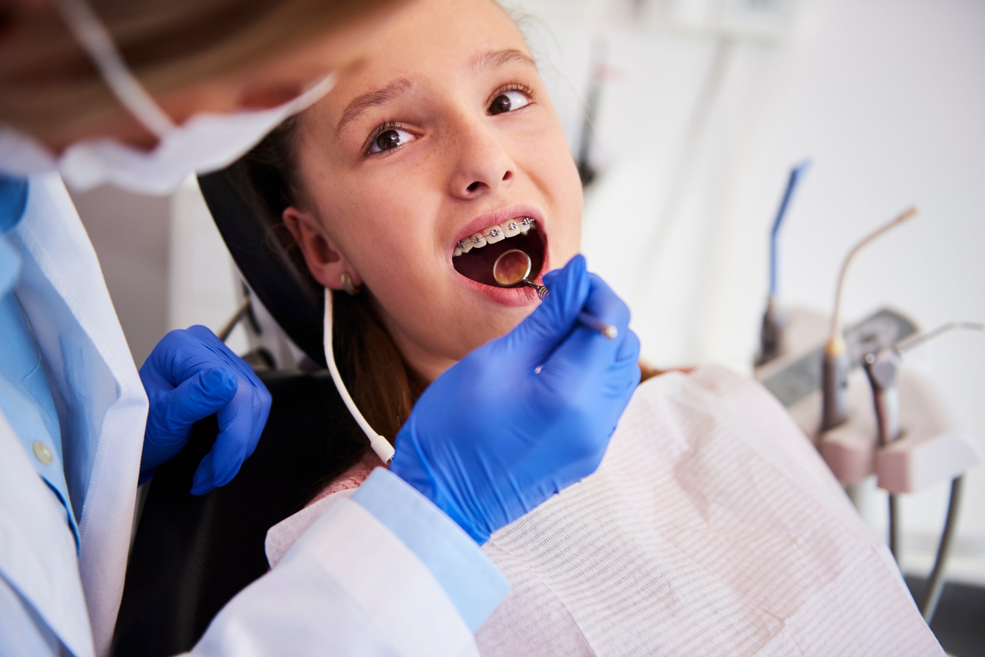 Top 5 Habits That Protect Kids' Teeth in Woodland Hills, CA