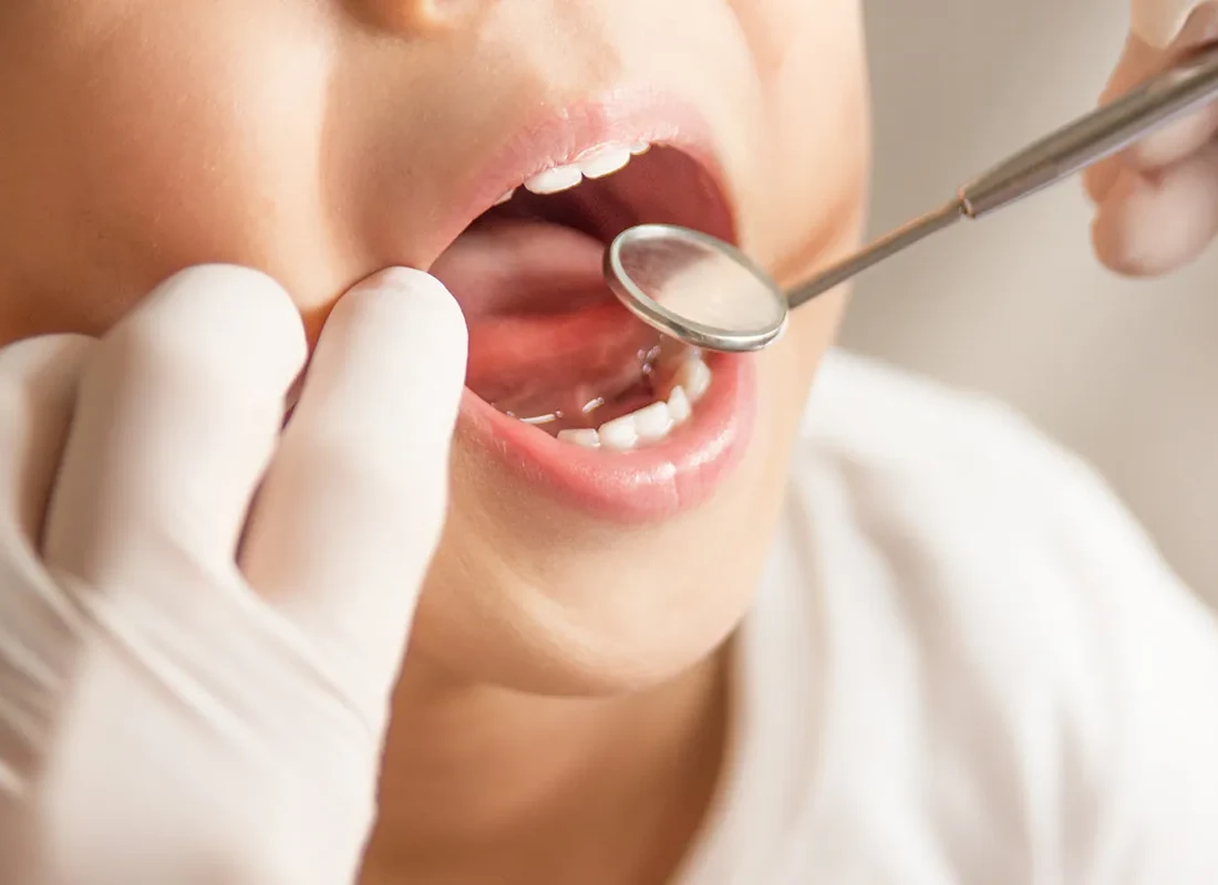 Top 5 Dental Habits to Teach Kids Before They Lose Their Baby Teeth
