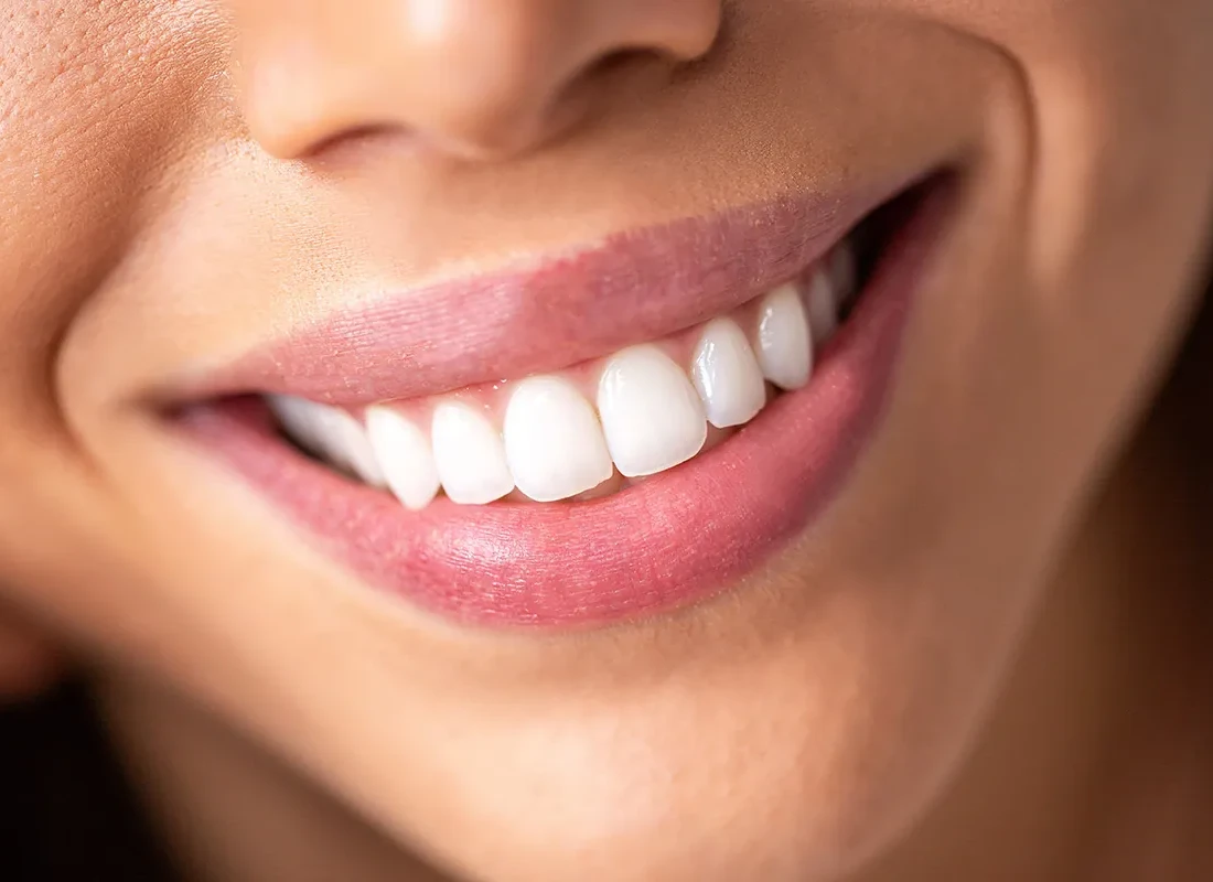What’s the Least Invasive Way to Completely Makeover My Smile?