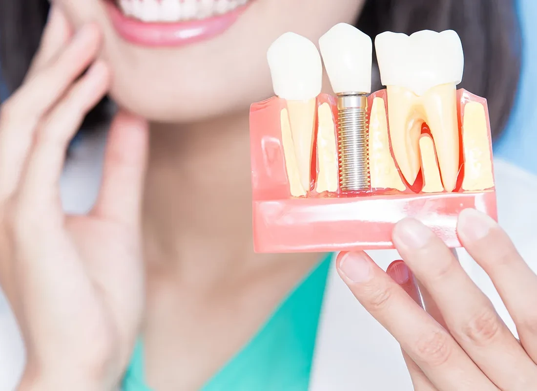 How Long Will a Dental Implant Last?