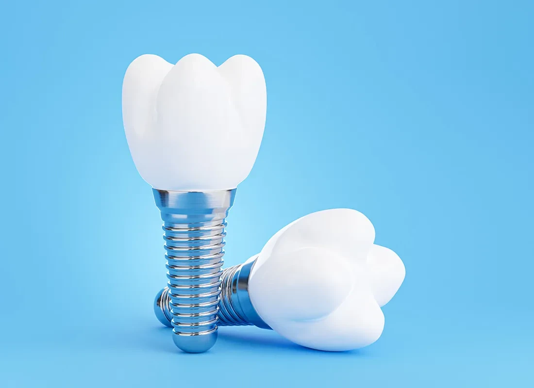Single Tooth Dental Implants: How Restoring One Tooth Saves Your Smile