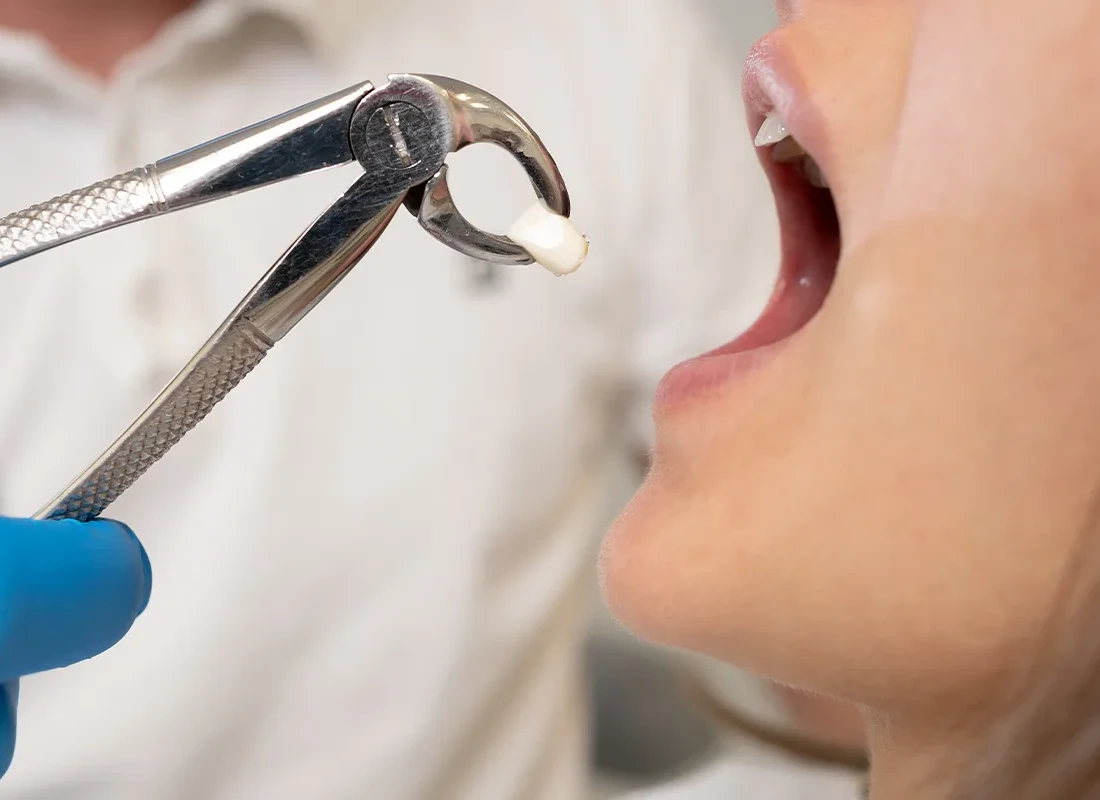 Navigating Tooth Extractions with Compassionate Care at Woodland Hills Family Dentistry